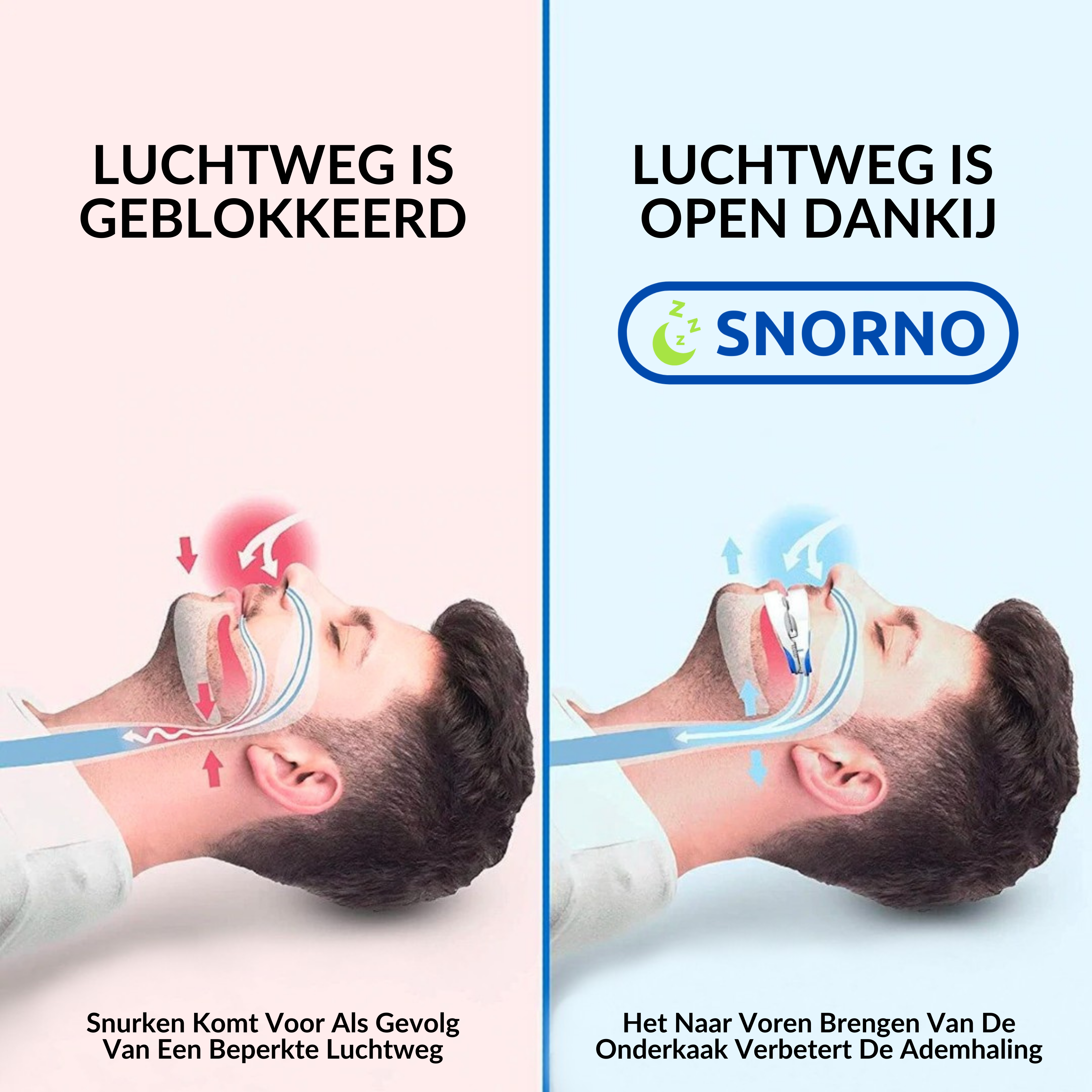 Effectieve Anti Snurk Beugel